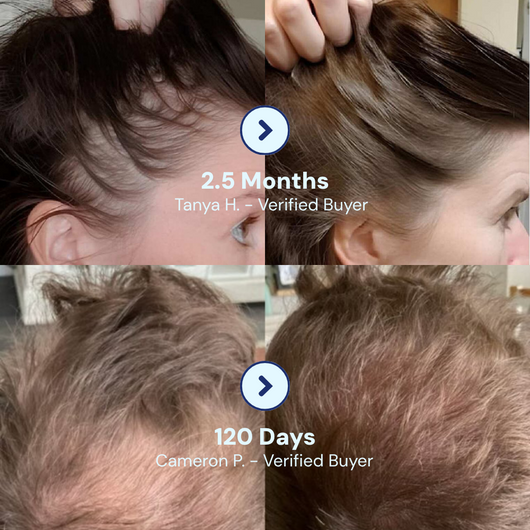 Emerged™ Hair Growth Roll On Pen