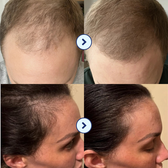 Feature product image